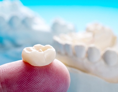 a dentist holding a dental crown in Ellicott City on their finger