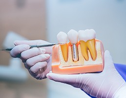 Dentist pointing to dental implant in Ellicott City
