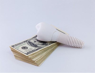 model dental implant and money representing cost of dental implants in Ellicott City