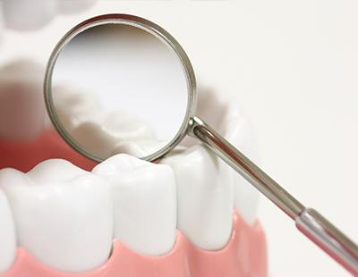 Dentist checking patient's teeth after dental sealant placement