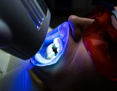An up-close look at how in-office teeth whitening works